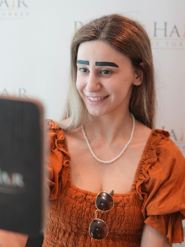 Patient seeing her new eyebrows in the mirror